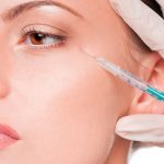 Dr.-Oscar-Hevia_10322854-cosmetic-botox-injection-in-the-female-face-eye-zone-isolated